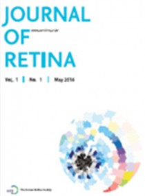 Retinal Tears in Fundus-obscuring Vitreous Hemorrhages of Unknown Cause: Risk Factors and Surgical Outcomes안저 관찰이 불가능한 원인 불명 유리체 출혈에서망막열공의 위험인자 및 수술 경과 표지